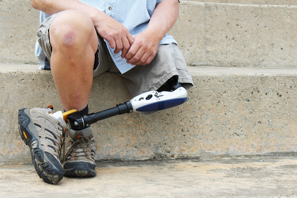 Amputee sitting on steps with legs crossed