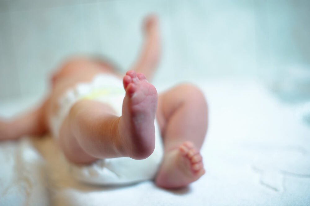 What Are the Most Common Birth Injuries? a newborn baby laying on their back with focus on feet