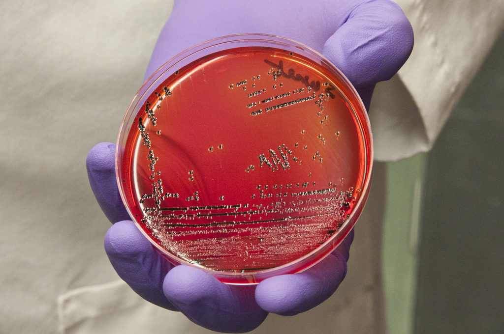 North Carolina Farm Recalls Over 206 Million Eggs for Suspected Salmonella