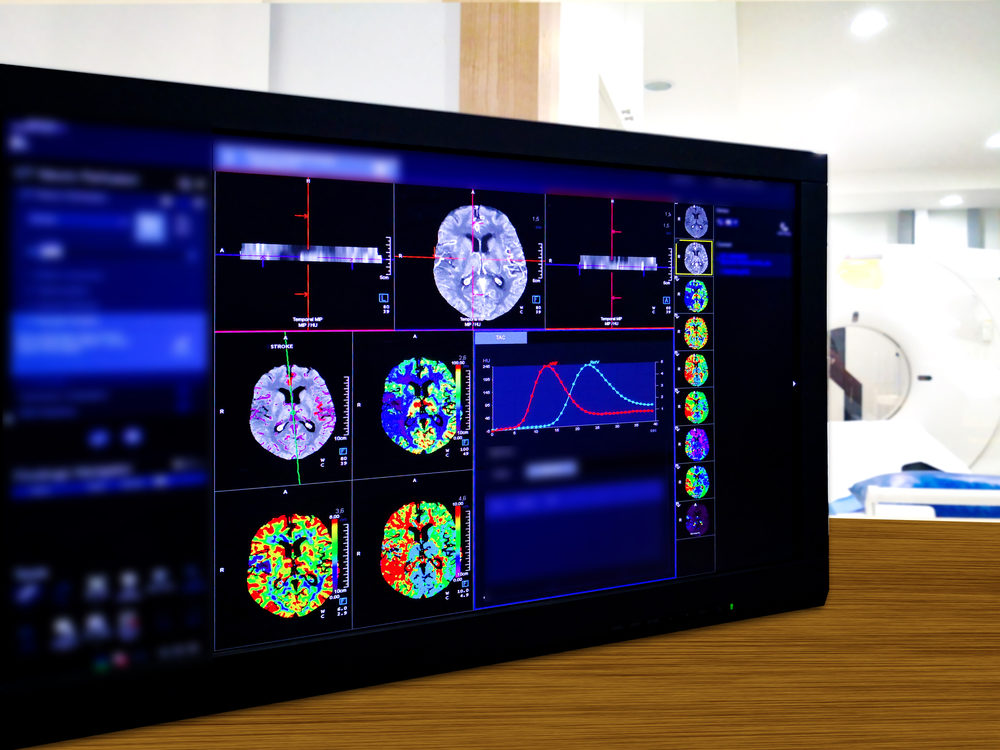 Brain Perfusion or CT scan of Blood flow in the brain 3d rendering image on the screen with CT Scan room.
