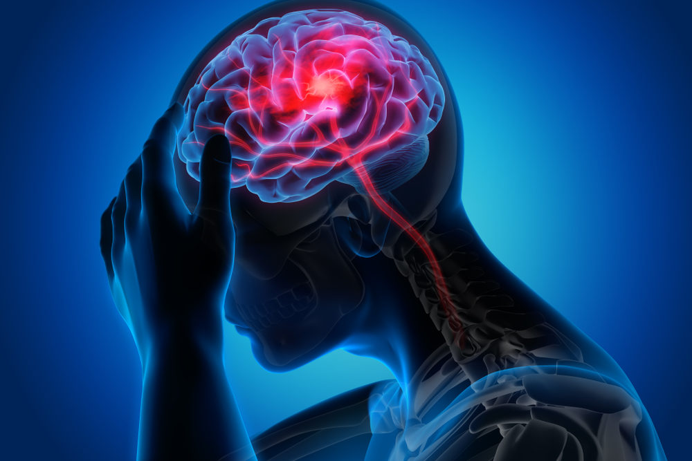 3D illustration of a man holding his head with brain showing headache