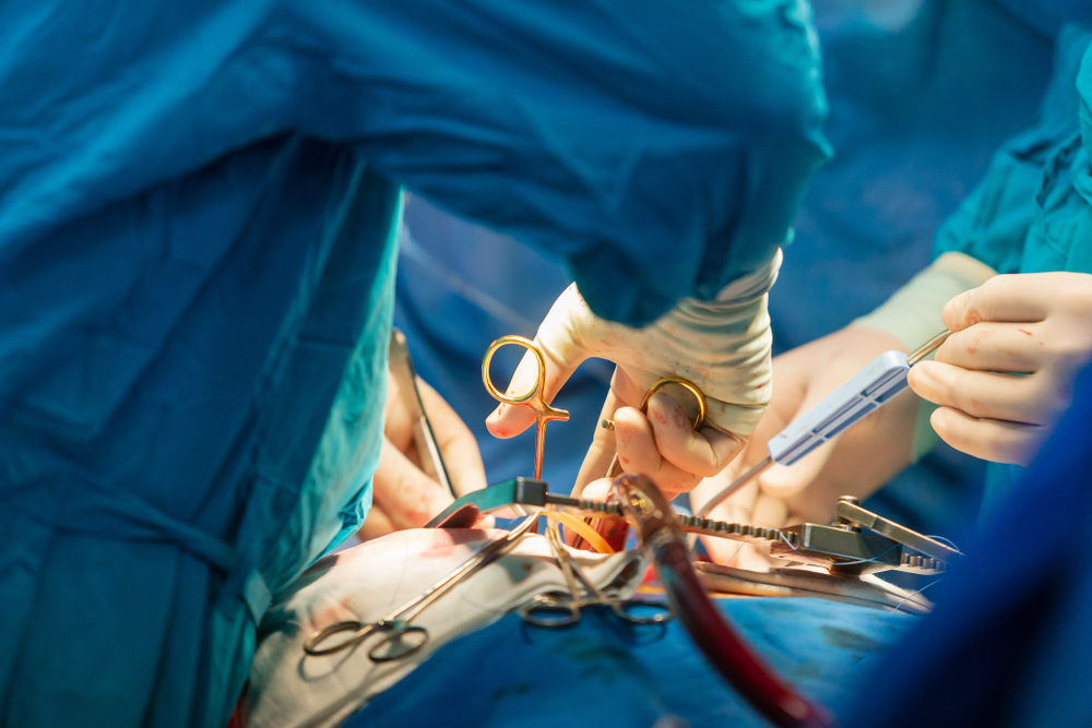 surgeons performing a Heart transplantation