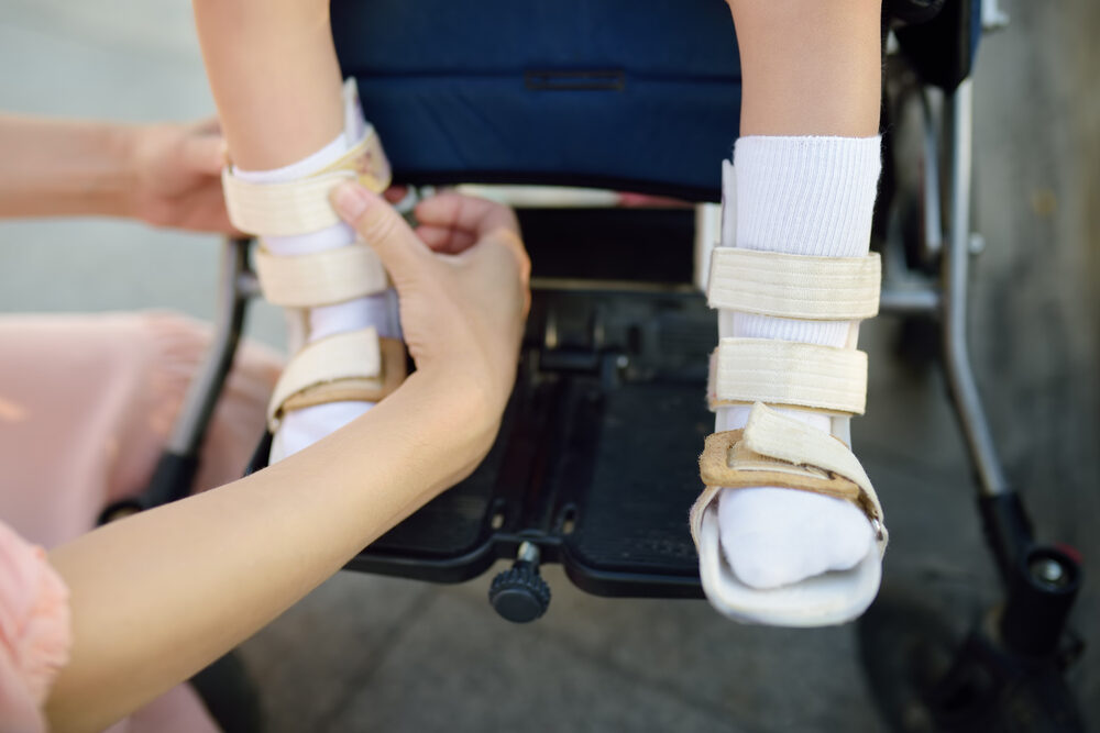 mother putting on her child with cerebral palsy's orthosis in wheelchair