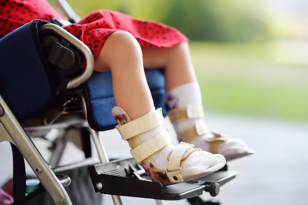 Disabled girl sitting in wheelchair.