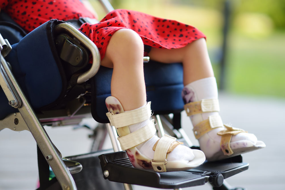 disabled girl sitting in a wheelchair