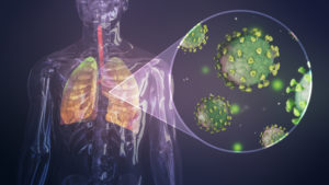 A rendering of coronavirus cells infecting the lungs