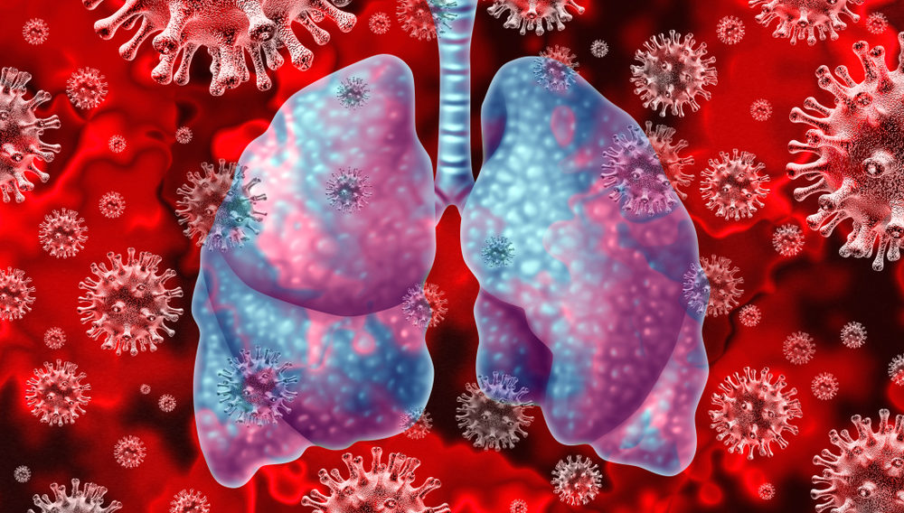 Human lungs surrounded by coronavirus cells (3d rendering)