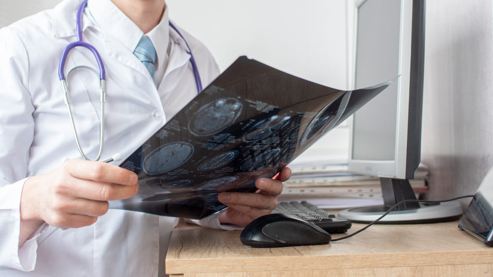 Brain Injury Research: CT Scans Help Doctors Estimate Future Treatment For Concussions and TBI, and Also Help Brain Injury Lawyers Prove Likelihood of Future Disability From Concussions A doctor viewing an MRI of the brain