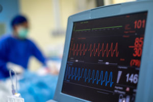 EKG monitor in intra aortic balloon pump machine.