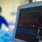 EKG monitor in intra aortic balloon pump machine.