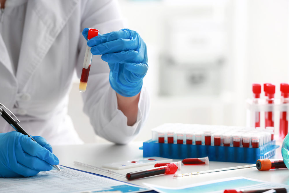 Woman working with blood sample in laboratory