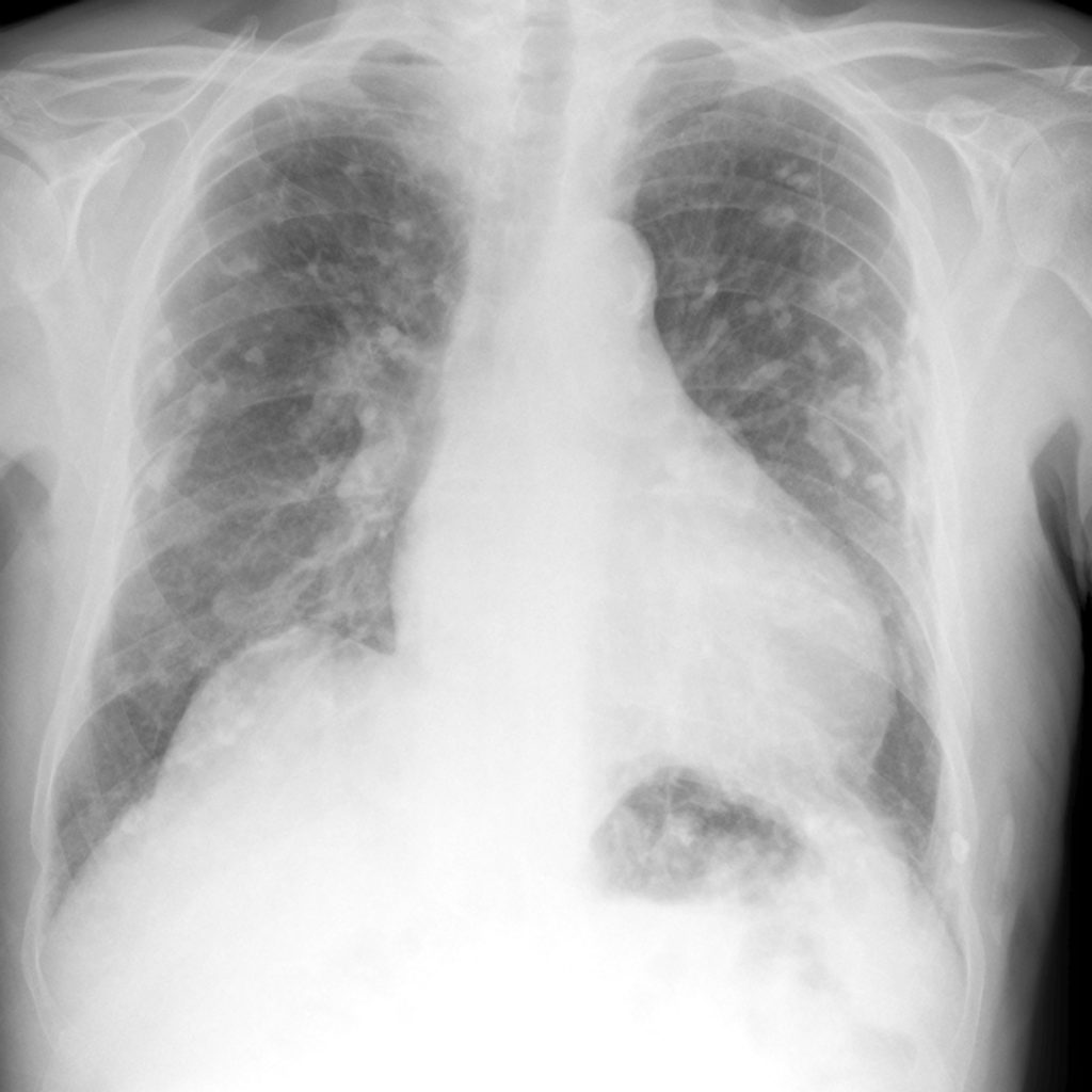 Study: Why Is the Rate of Radiology Errors So High? Study: Why Is the Rate of Radiology Errors So High?