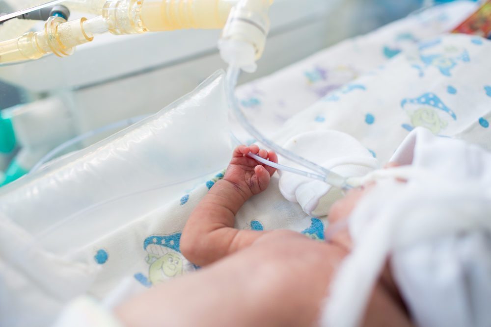 premature baby hand lying inside the incubator with oxygen mask