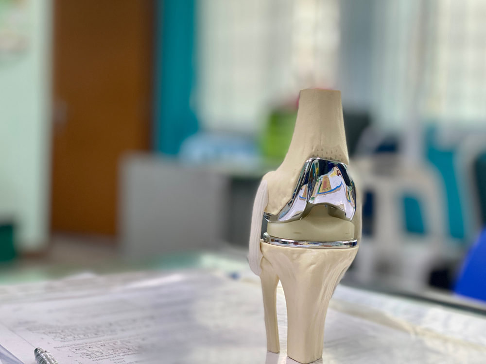 An anatomical model of a knee with total replacement in a clinic