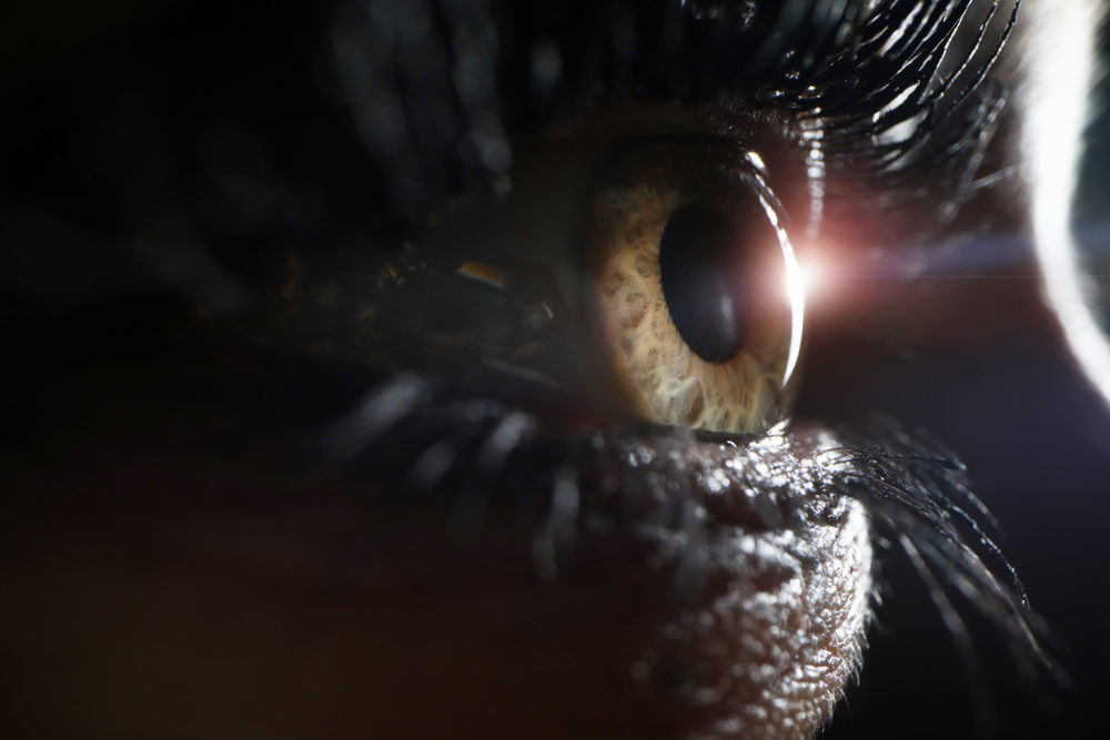 Stem Cells Used To Repair Damaged Corneas Female eye on surgery clinic exam closeup