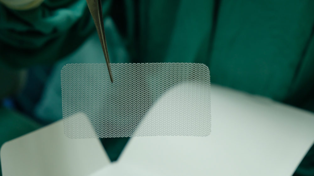 Synthetic Mesh used in Hernia repair.