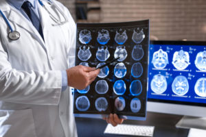 Senior neurologist with MRI scan of human head in clinic