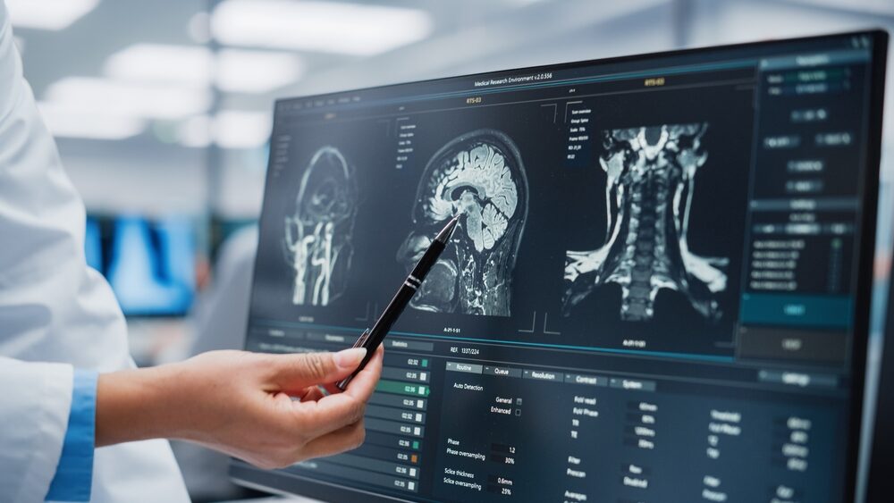 neurologist analyzing a patient's mri on a computer screen