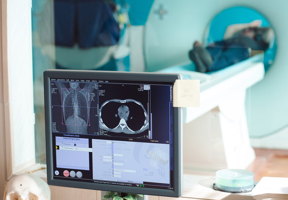 patient in an mri machine with screen showing scan