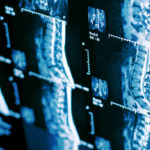 MRI scan of human spine