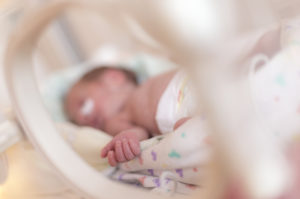 Premature newborn baby in incubator after c-section.