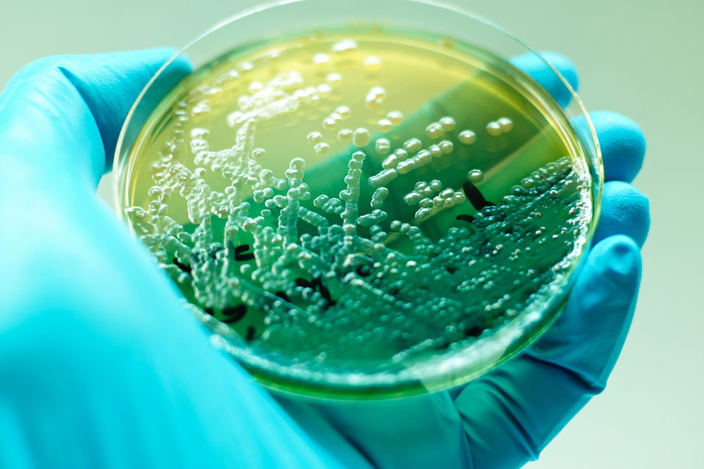 Pseudomonas aeruginosa colonies as test on MacConkey agar plate