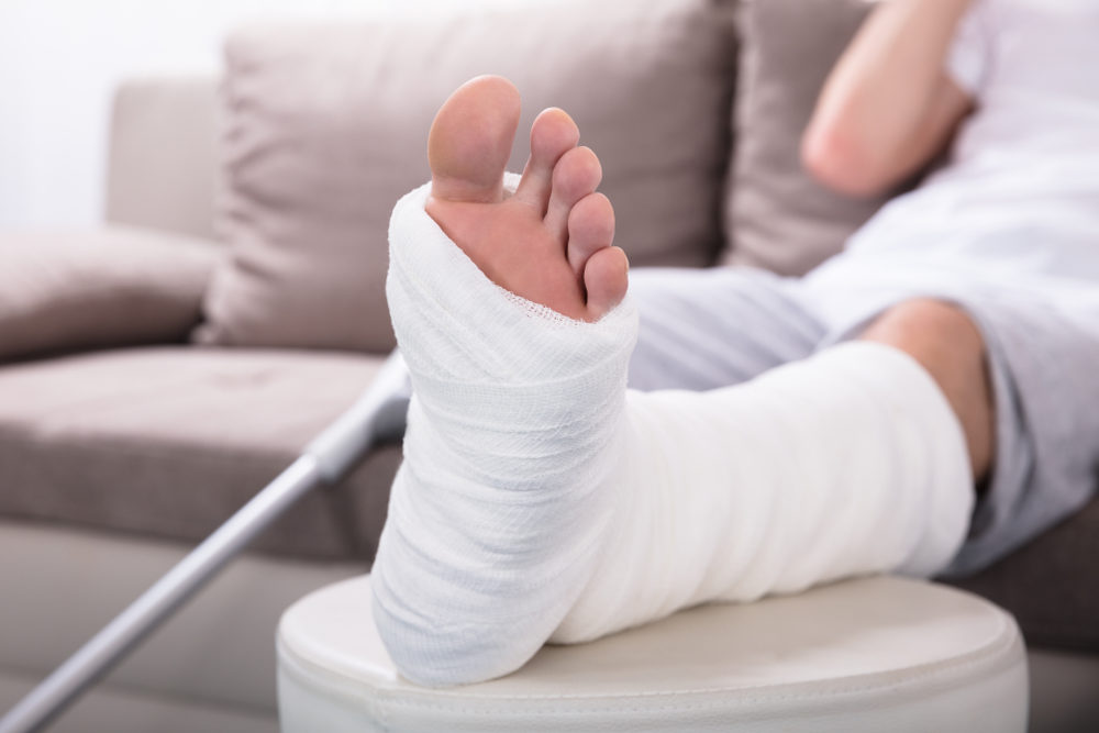 Most Common Fracture Injuries Suffered in Vehicle Crashes