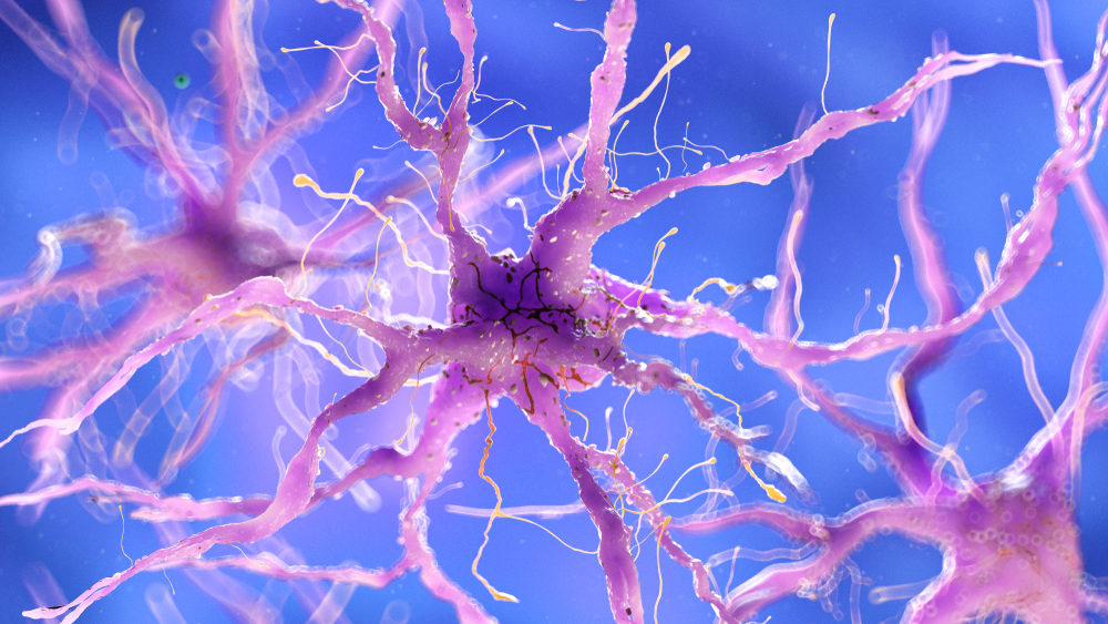 3d rendering of a damaged nerve cell