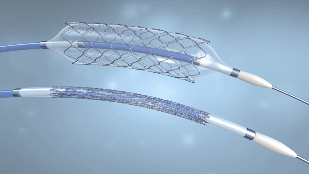 Heart stent renderings, one with inflated balloon and one without