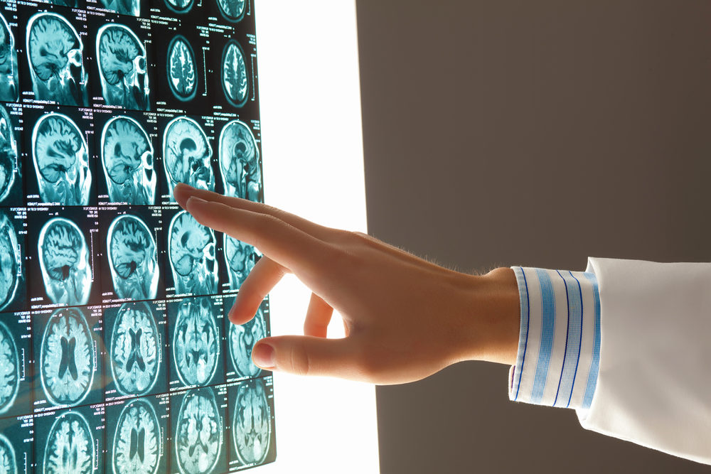 Is Brain Cooling Ineffective in Treating Traumatic Brain Injury?