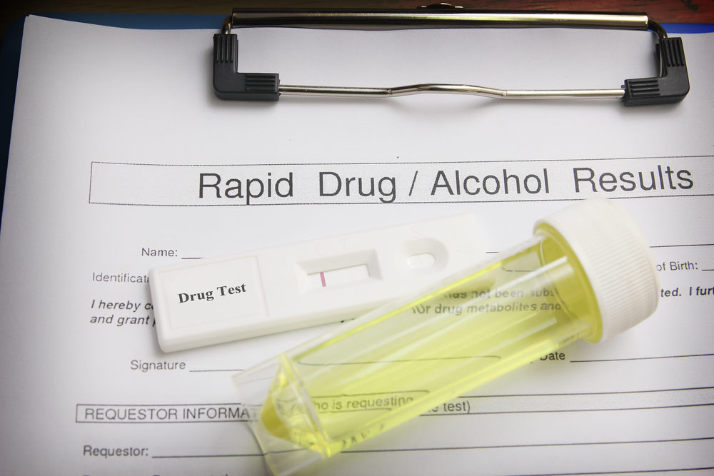 Do I Need To Take a Drug Test When Filing a Florida Workers’ Comp Claim?