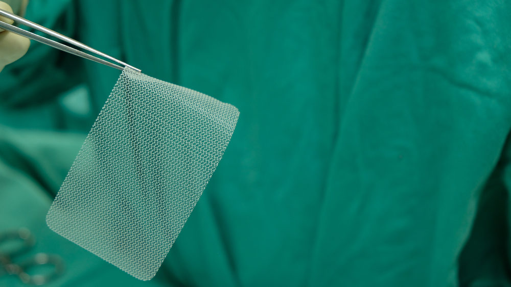 Hernia Mesh Medical Complications Continue to Ruin Patients’ Lives