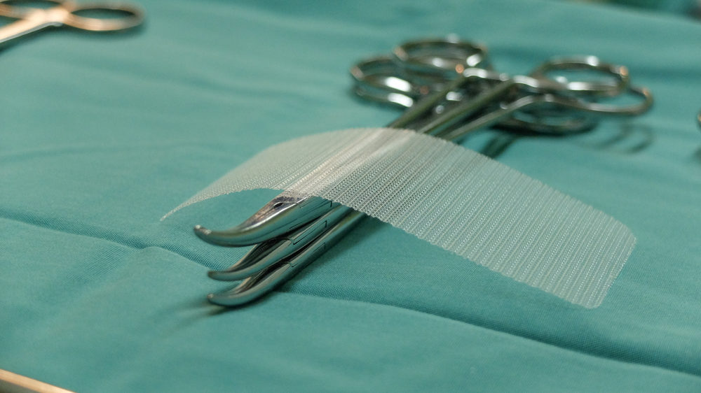 Hernia Mesh Lawsuits Mounting