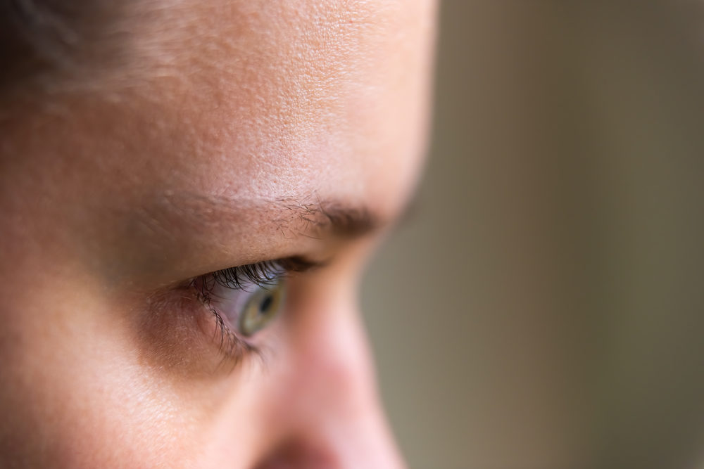 closeup of young woman face portrait in profile side with Grave's disease hyperthyroidism symptoms of ophthalmopathy bulging eyes