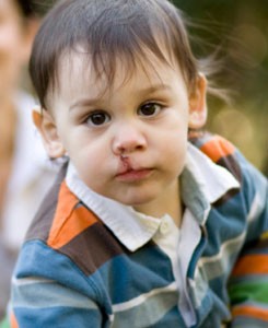 zofran and birth defects