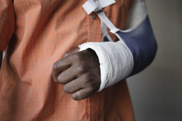 A man's arm in a cast with a sling