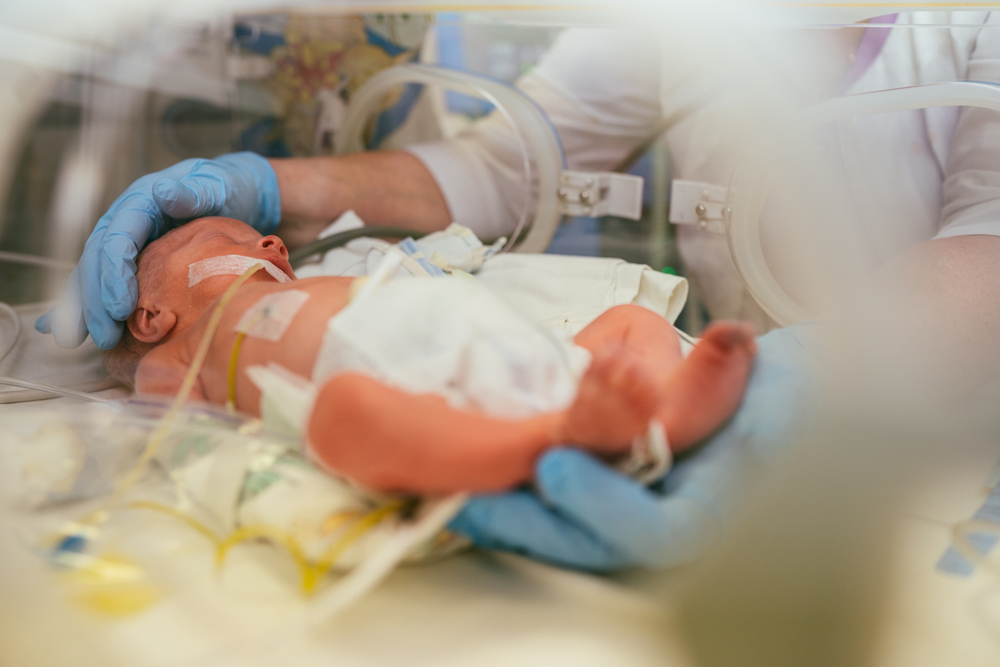 Three-day-old newborn baby in intensive care unit in a medical incubator.