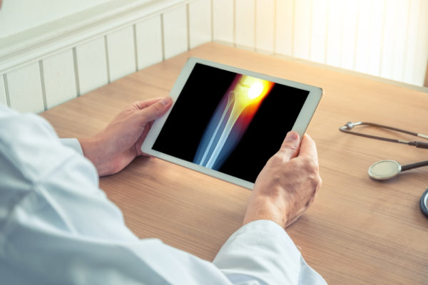 Doctor holding a digital tablet with x-ray of the leg.