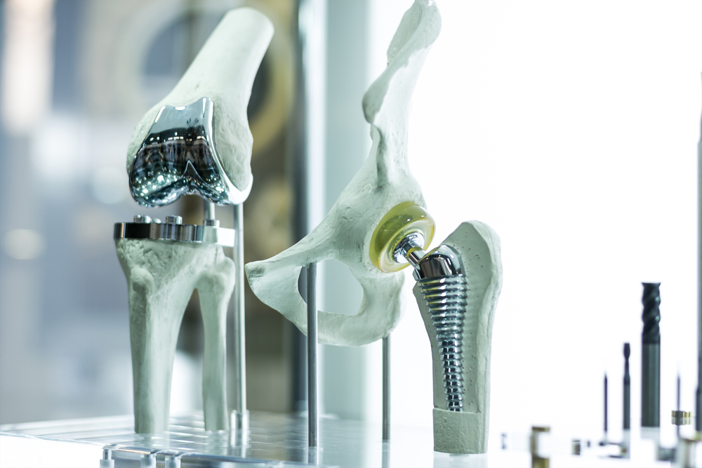 closeup of knee and hip replacement exactech recall