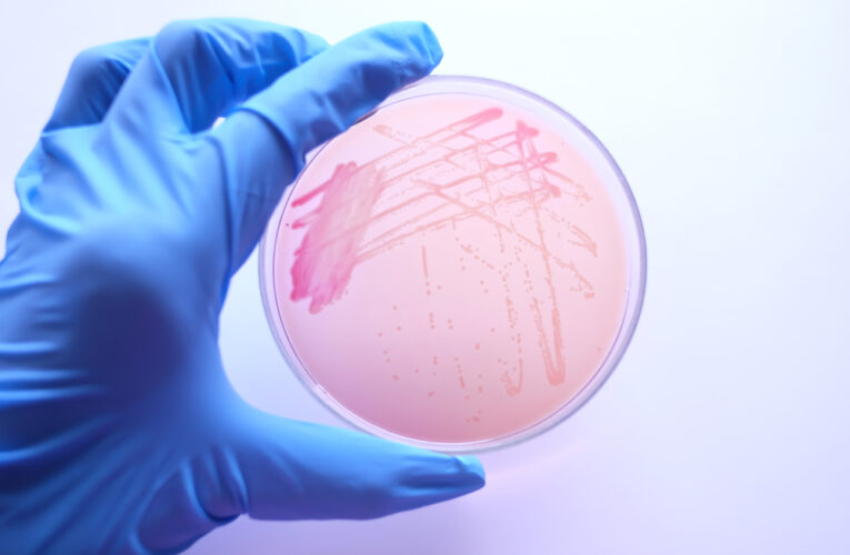 Scientist Hand with glove holding MacConkey agar plate which contain colonies of Cronobacter sakazakii bacteria