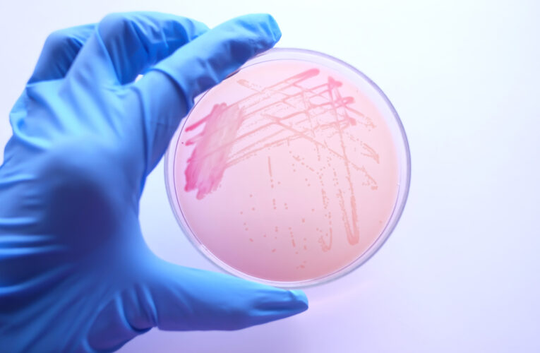Scientist Hand with glove holding MacConkey agar plate which contain colonies of Cronobacter sakazakii bacteria