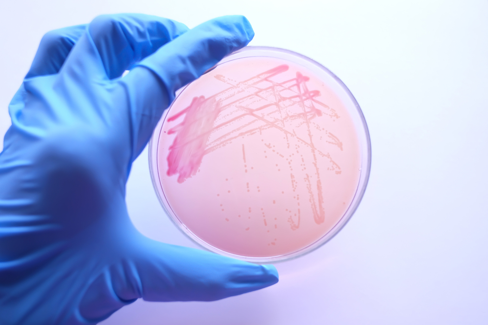Scientist Hand with glove holding MacConkey agar plate which contain colonies of Cronobacter sakazakii bacteria