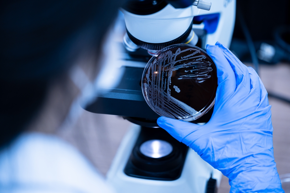 Scientist holding agar plate for diagnosis bacterial or microorganism,microscope in background at laboratory.