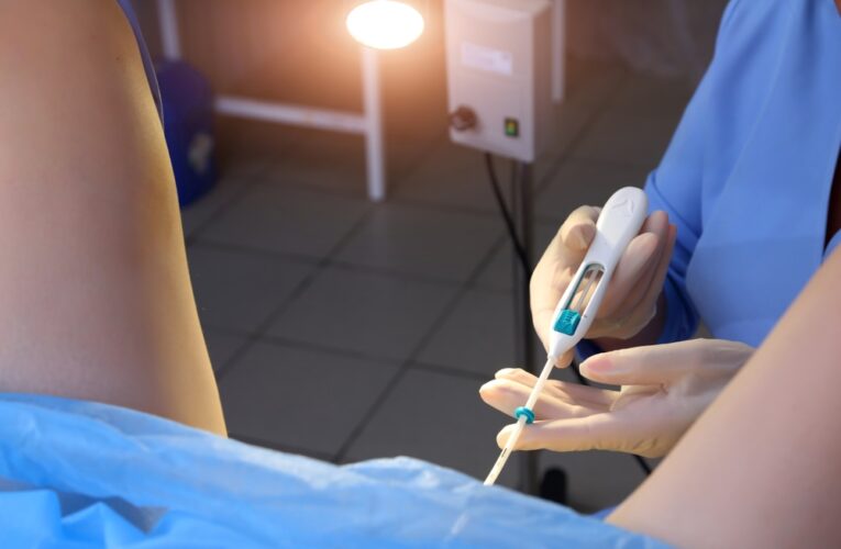 gynecologist installing paragard iud using new placement method